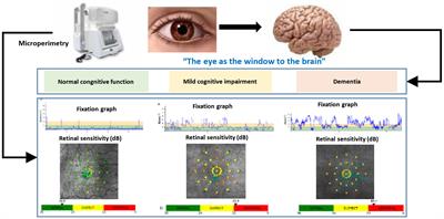 New methods for the diagnosis and monitoring of cognitive function in patients with type 2 diabetes